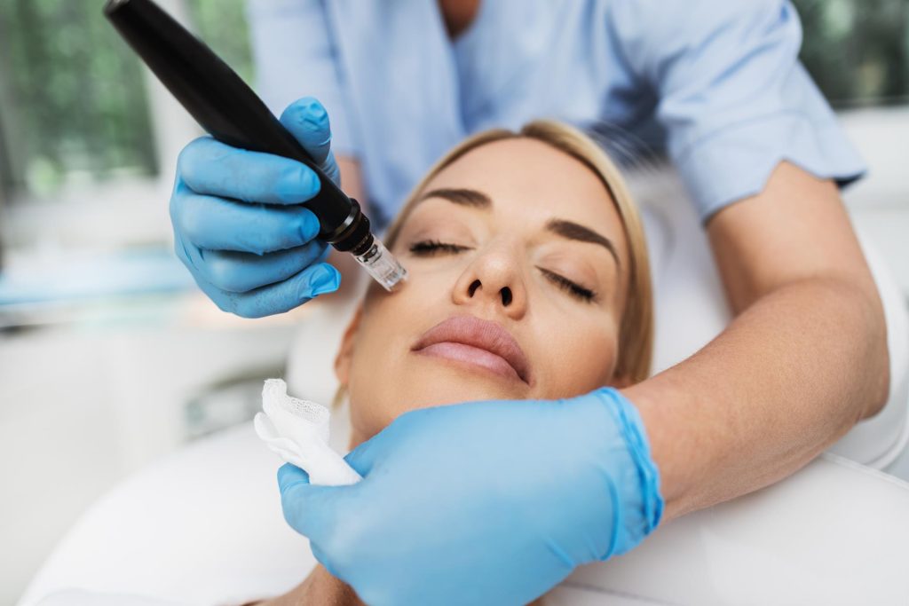 SkinPen microneedling treatment